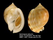 Semicassis saburon (7)